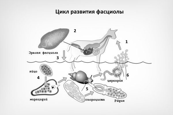 Клиническая картина фасциолеза