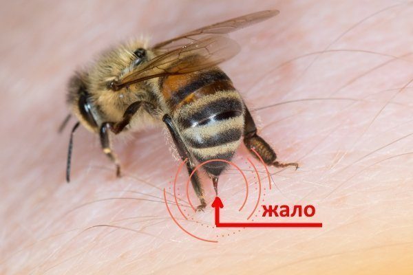 Почему пчела умирает, когда жалит?