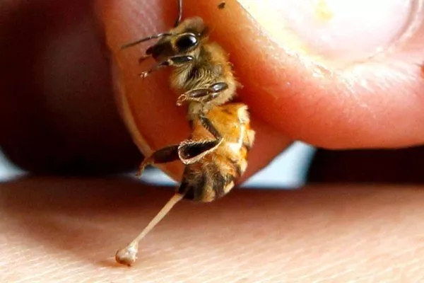 Каки жалит пчела