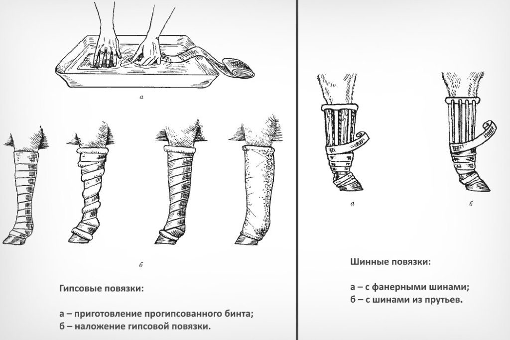 Гипсовые повязки шины. Наложение гипсовой повязки. Шарнирная гипсовая повязка. Классификация гипсовых повязок. Техника наложения гипсовой повязки.