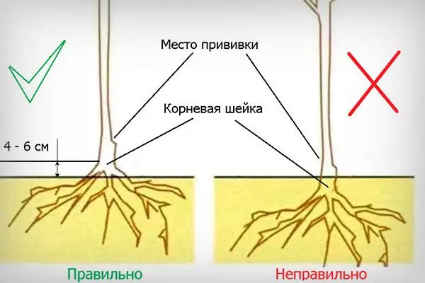 Заглублённая шейка2