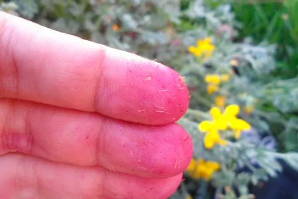 иголки в пальце уход за колючими кактусами8