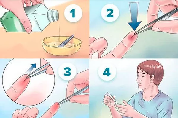 удалить пинцетом уход за колючими кактусами24